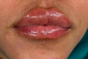 Resultado final del tratamiento de micropigmentación de labios en la estética avanzada Ari Beauty Martínez