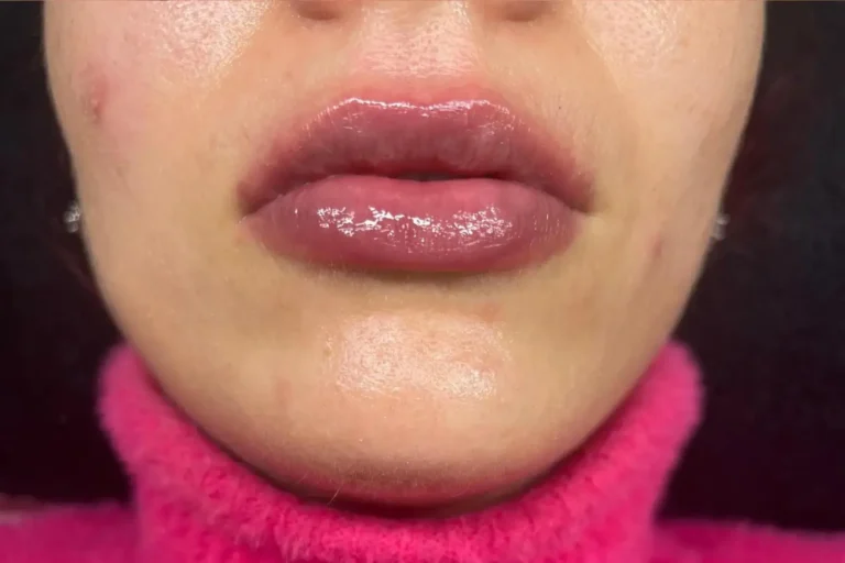 Labios con color después del tratamiento de micropigmentación de labios en la estética avanzada Ari Beauty Martínez