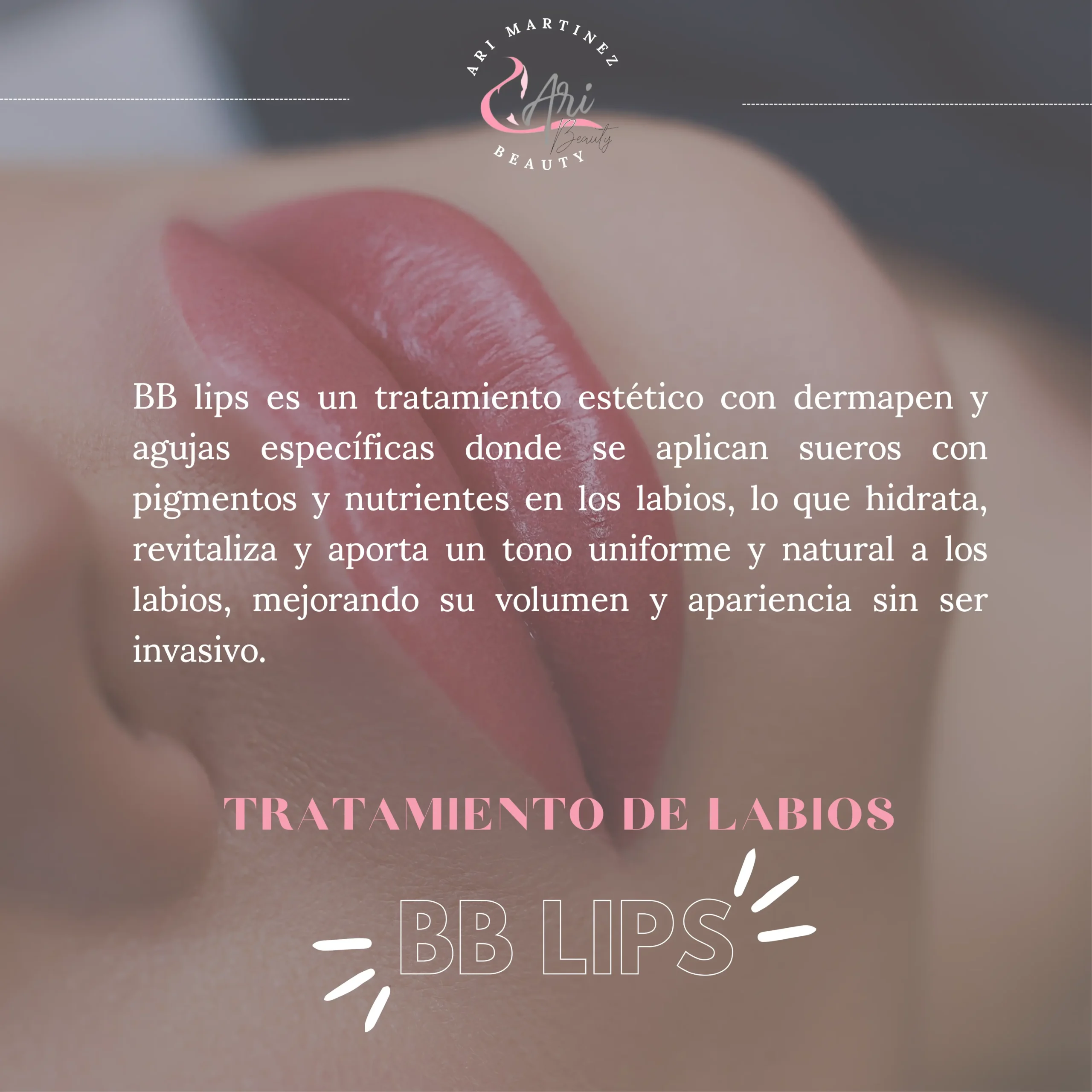 Información sobre tratamiento BB Lips en Ari Martínez Beauty del curso profesional "Belleza en Acción"