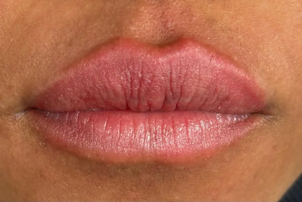 Labios con apariencia natural después de tratamiento en Ari Martínez Beauty