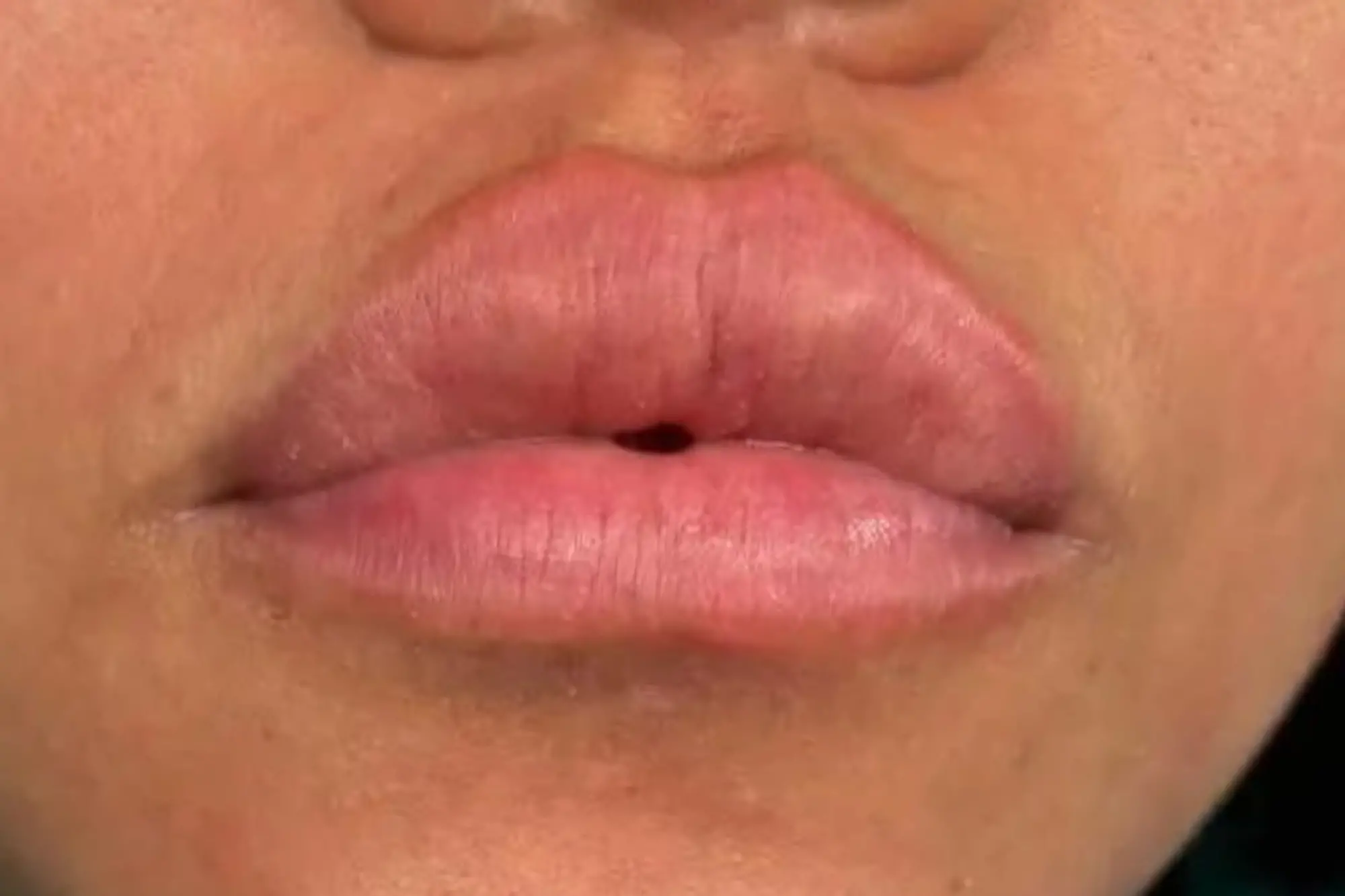 labios antes de tratamiento de micropigmentación en en la estética avanzada de Ari Martinez Beauty