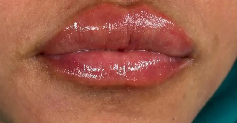 Resultado final del tratamiento de micropigmentación de labios en la estética avanzada Ari Beauty Martínez