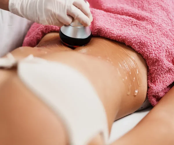 Tratamiento de cavitacion en abdomen con radiofrecuencia en Ari Martínez Beauty