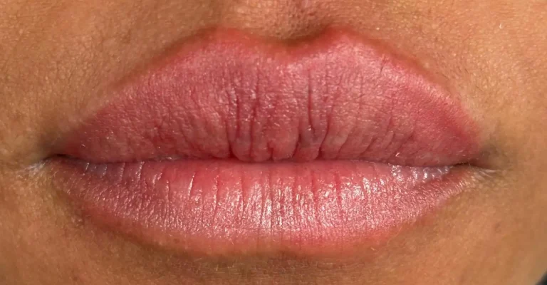 Labios con apariencia natural después de tratamiento en Ari Martínez Beauty